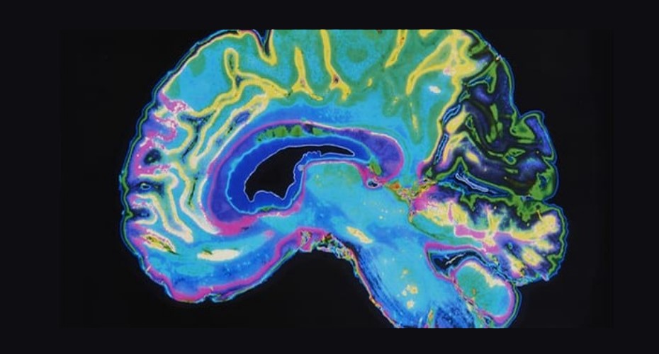 Brain scan image