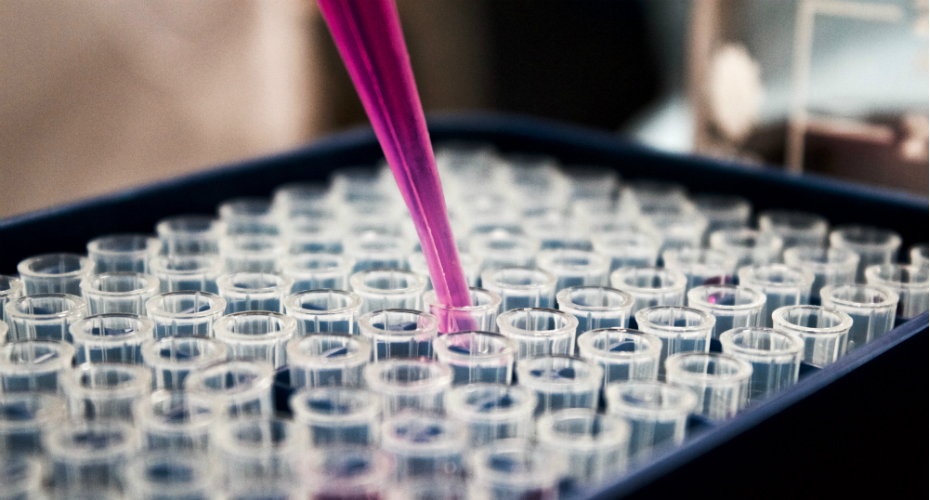 Close up of a pipette dropping samples into test tubes