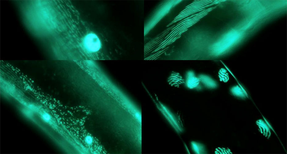 Green and black close-up images of c. elegans under a microscope