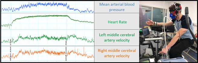 Graphs showing mean arterial blood pressure, heart rate, left middle cerebral artery velocity, right middle cerebral artery velocity: next to a photo of a participant on an ergometer.